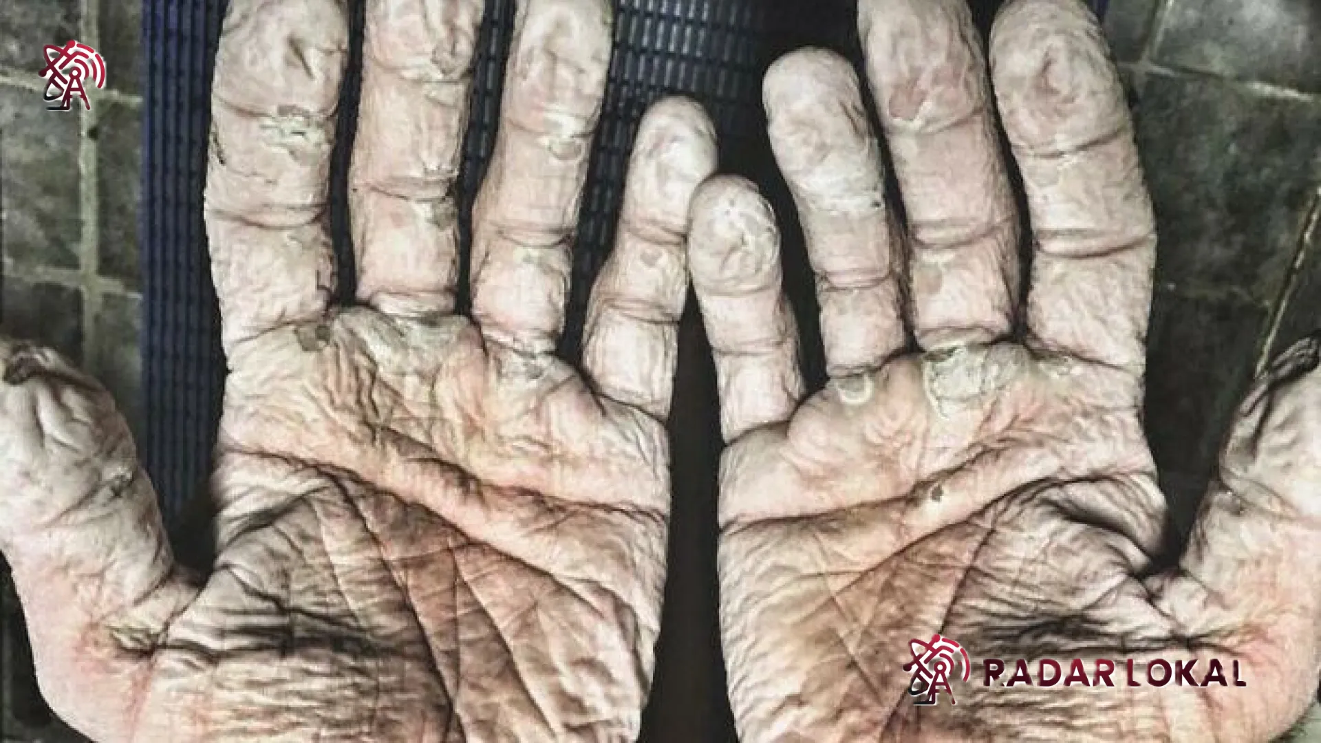 Misteri Anatomi: Menyingkap Kondisi Medis Langka yang Mengguncang Nalar Manusia